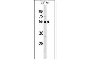 Image no. 1 for anti-Retinoblastoma Binding Protein 7 (RBBP7) (AA 191-219) antibody (ABIN5532018)