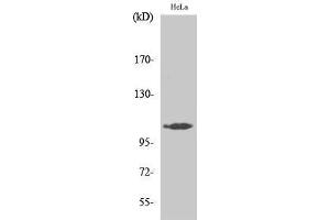 Image no. 1 for anti-Mitogen-Activated Protein Kinase Kinase Kinase 13 (MAP3K13) (Internal Region) antibody (ABIN3185428)