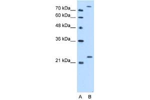Image no. 1 for anti-Protein-L-Isoaspartate (D-Aspartate) O-Methyltransferase (PCMT1) (Middle Region) antibody (ABIN2773925)