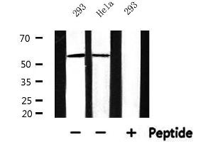 anti-Cytochrome P450, Family 17, Subfamily A, Polypeptide 1 (CYP17A1) (Internal Region) antibody