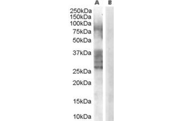 anti-ADAM Metallopeptidase Domain 33 (ADAM33) (Internal Region) antibody