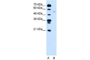 Image no. 4 for anti-Cyclin B1 (CCNB1) (C-Term) antibody (ABIN2779290)