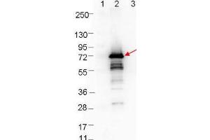 Western Blotting (WB) image for anti-Borrelia Burgdorferi Outer Surface Protein A (OspA) antibody (ABIN964719)