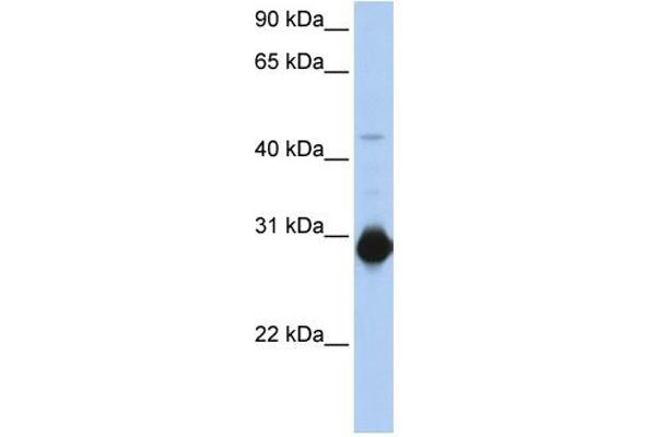 RHOU antibody  (C-Term)