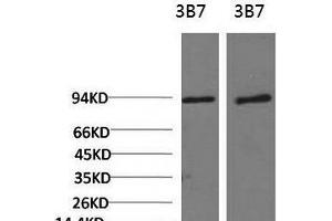 Western Blot analysis of 1) 3T3, 2) Rat liver using PI 3 kinase p85 alpha Monoclonal Antibody at dilution of 1:2000.