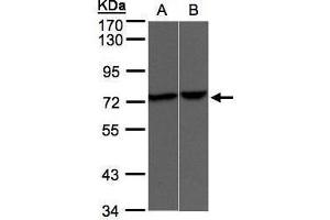 Image no. 1 for anti-Transient Receptor Potential Cation Channel, Subfamily V, Member 2 (TRPV2) (C-Term) antibody (ABIN2855207)