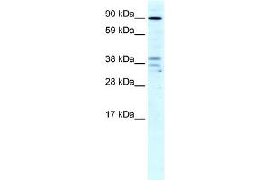 Image no. 1 for anti-Zinc Finger CCCH-Type Containing 7B (ZC3H7B) (N-Term) antibody (ABIN2779684)