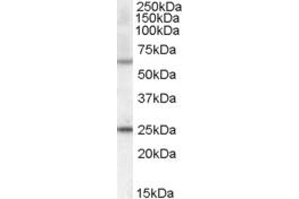 anti-Collagen, Type IV, alpha 3 (Goodpasture Antigen) Binding Protein (COL4A3BP) (AA 662-672) antibody