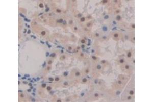Image no. 2 for anti-Pygopus Homolog 2 (PYGO2) (AA 171-406) antibody (ABIN5014237)