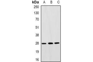 Image no. 2 for anti-General Transcription Factor IIF, Polypeptide 2, 30kDa (GTF2F2) (full length) antibody (ABIN6004276)