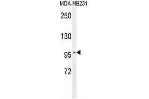 Image no. 2 for anti-Suppression of Tumorigenicity 7 (ST7) (AA 176-205), (Middle Region) antibody (ABIN954962)