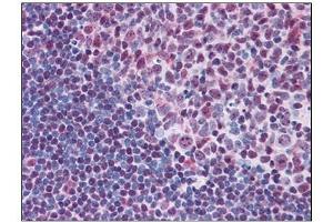 Image no. 3 for anti-V-Myb Myeloblastosis Viral Oncogene Homolog (Avian) (MYB) (N-Term) antibody (ABIN784094)