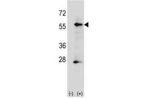 Image no. 3 for anti-Alkaline Phosphatase (ALP) (AA 56-83) antibody (ABIN3029911)