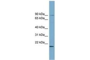 Image no. 1 for anti-UFM1-Specific Ligase 1 (UFL1) (AA 503-552) antibody (ABIN6743812)