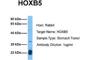 Image no. 1 for anti-Homeobox B5 (HOXB5) (N-Term) antibody (ABIN2777303)