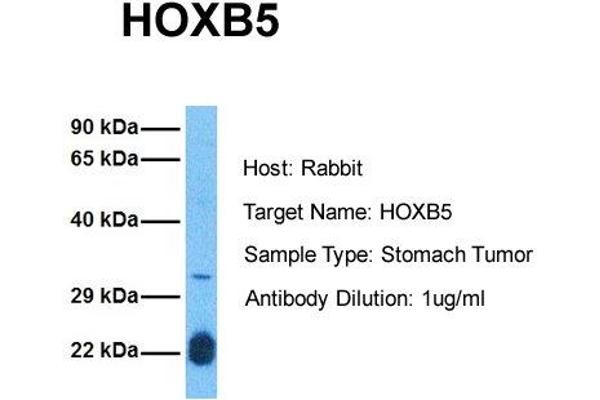 anti-Homeobox B5 (HOXB5) (N-Term) antibody
