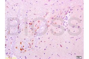 Image no. 1 for anti-Glial Cell Line Derived Neurotrophic Factor (GDNF) (AA 121-211) antibody (ABIN736536)