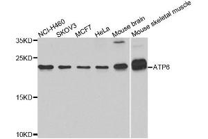 Image no. 1 for anti-Mitochondrially Encoded ATP Synthase 6 (MT-ATP6) antibody (ABIN6137340)