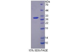 Image no. 1 for Membrane Protein, Palmitoylated 2 (MAGUK P55 Subfamily Member 2) (MPP2) (AA 345-573) protein (His tag) (ABIN6236682)