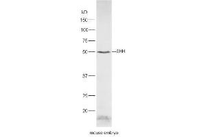 Image no. 5 for anti-Sonic Hedgehog (SHH) (AA 21-120) antibody (ABIN731108)