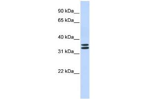 Image no. 2 for anti-T-Cell Acute Lymphocytic Leukemia 1 (TAL1) (N-Term) antibody (ABIN2777291)