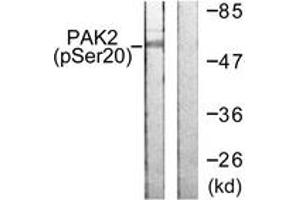 Image no. 1 for anti-P21-Activated Kinase 2 (PAK2) (AA 5-54), (pSer20) antibody (ABIN1531457)