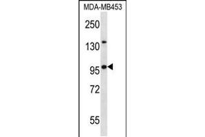 Image no. 1 for anti-Nucleoporin 88kDa (NUP88) (AA 701-730), (C-Term) antibody (ABIN5533203)