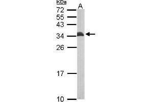 Image no. 1 for anti-Electron-Transfer-Flavoprotein, beta Polypeptide (ETFB) (Center) antibody (ABIN2856657)