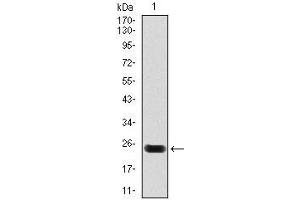 Image no. 3 for anti-Cardiac Troponin T (cTnT) antibody (ABIN969445)