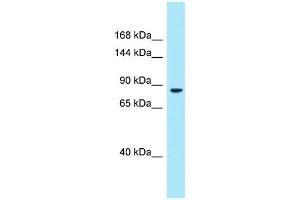 Image no. 1 for anti-Dimethylglycine Dehydrogenase (DMGDH) (C-Term) antibody (ABIN2789894)