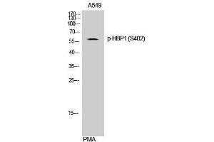 Image no. 1 for anti-HMG Box-Containing Protein 1 (HBP1) (pSer402) antibody (ABIN3182263)