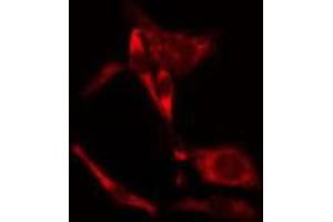 Image no. 1 for anti-Pseudopodium-Enriched Atypical Kinase 1 (PEAK1) (Internal Region) antibody (ABIN6259612)