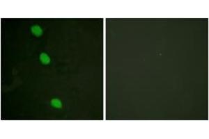 Immunofluorescence analysis of HeLa cells, using CaMK4 (Phospho-Thr196/200) Antibody.