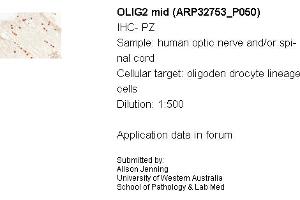 Image no. 1 for anti-Oligodendrocyte Lineage Transcription Factor 2 (OLIG2) (C-Term) antibody (ABIN2777566)