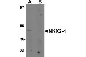 Image no. 1 for anti-NK2 Homeobox 4 (NKX2-4) (Middle Region) antibody (ABIN1031021)