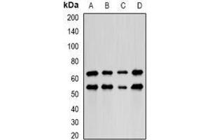 Image no. 1 for anti-PDZ and LIM Domain 5 (PDLIM5) (full length) antibody (ABIN6005914)