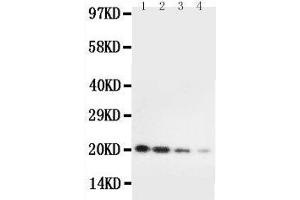 Image no. 1 for anti-Interleukin 10 (IL10) (AA 19-178) antibody (ABIN3042803)