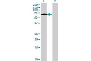 Image no. 1 for anti-serine Peptidase Inhibitor, Kunitz Type 1 (SPINT1) (AA 1-513) antibody (ABIN520434)