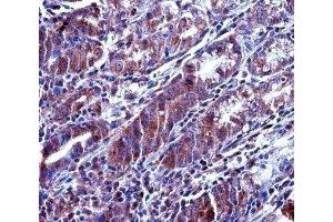 MCL1 antibody immunohistochemistry analysis in formalin fixed and paraffin embedded human stomach tissue.