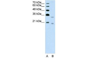 Image no. 1 for anti-Deoxyribonuclease II beta (DNASE2B) (C-Term) antibody (ABIN630127)