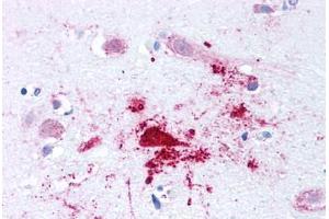 Human Brain, Alzheimers (formalin-fixed, paraffin-embedded) stained with BACE1 antibody ABIN213580 at 2.