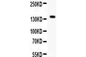 Image no. 1 for anti-Fms-Related tyrosine Kinase 1 (VEGFR1) (FLT1) (AA 278-298), (N-Term) antibody (ABIN3042978)