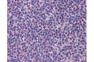Image no. 2 for anti-Promyelocytic Leukemia (PML) (C-Term) antibody (ABIN927422)