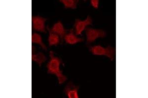 Image no. 1 for anti-Chloride Channel Ka (CLCNKA) (C-Term) antibody (ABIN6257101)