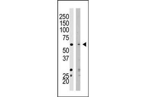 Image no. 1 for anti-SET Domain Containing (Lysine Methyltransferase) 8 (SETD8) (N-Term) antibody (ABIN356687)