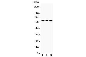 Image no. 2 for anti-Protein Kinase C, beta 1 (Pkc beta 1) (AA 542-671) antibody (ABIN3029750)