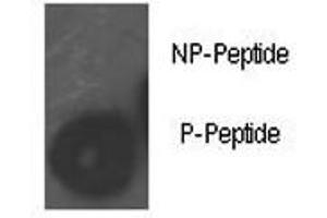 Image no. 3 for anti-Retinoblastoma Protein (Rb Protein) (pSer780) antibody (ABIN3032466)