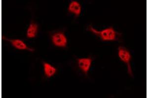 BARD1 antibody  (Internal Region)