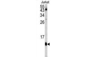 Image no. 3 for anti-FK506 Binding Protein 1A, 12kDa (FKBP1A) antibody (ABIN3003472)