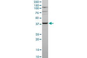 Image no. 2 for anti-Mevalonate Kinase (MVK) (AA 297-396) antibody (ABIN561885)